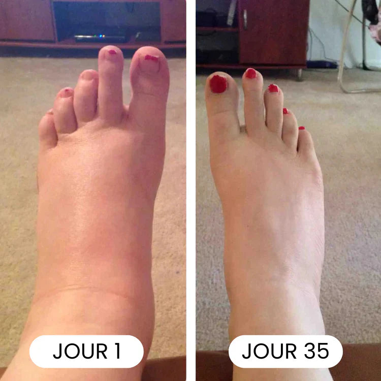 DRAINANT LYMPHATIQUE